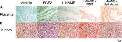 Fibroblast Growth Factor Type 2 (FGF2) Administration Attenuated the Clinical Manifestations of Preeclampsia in a Murine Model Induced by L-NAME